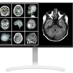 Monitor 27" LG 27HJ712C-W.AEU 8MP Clinical Review, Panel Type: IPS